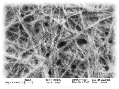 The picture below shows the white silver nanoparticles bound to cellulose fibers